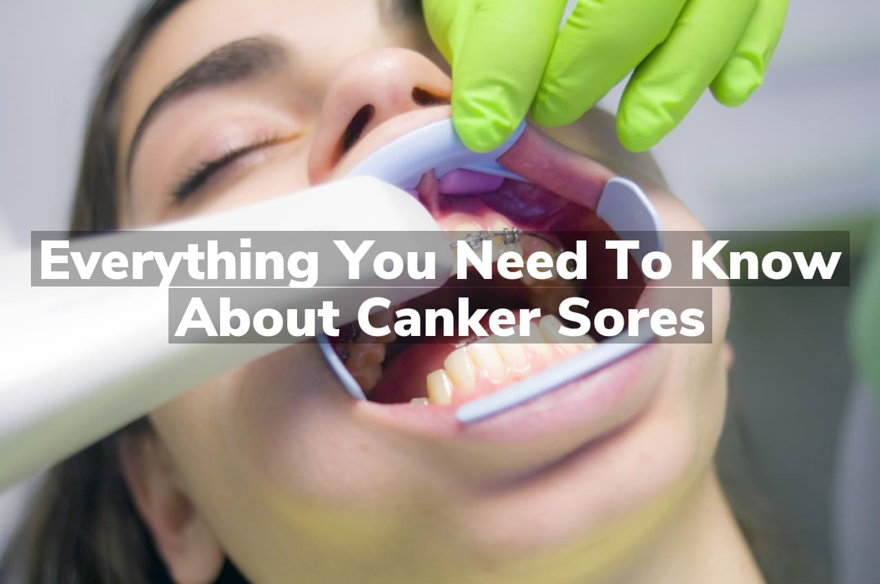 Everything You Need to Know About Canker Sores