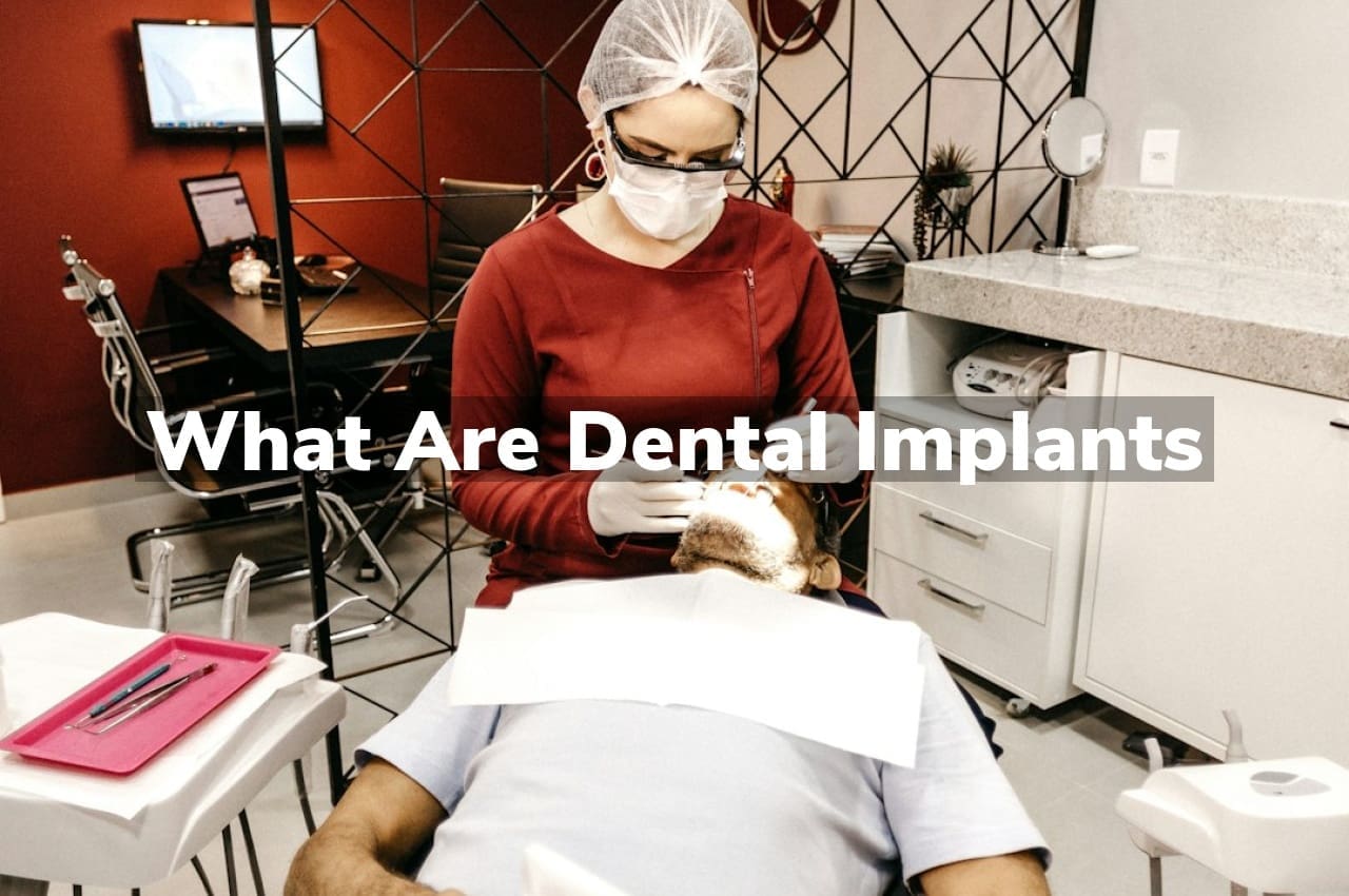 What are Dental Implants